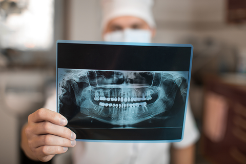 Illustration representing a dental X-ray